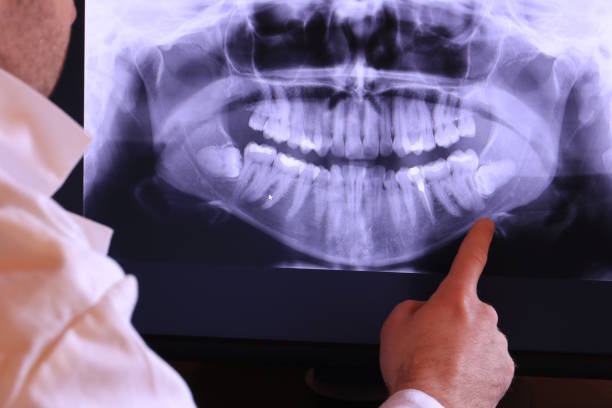 Best Emergency Denture Repair in Winder, GA